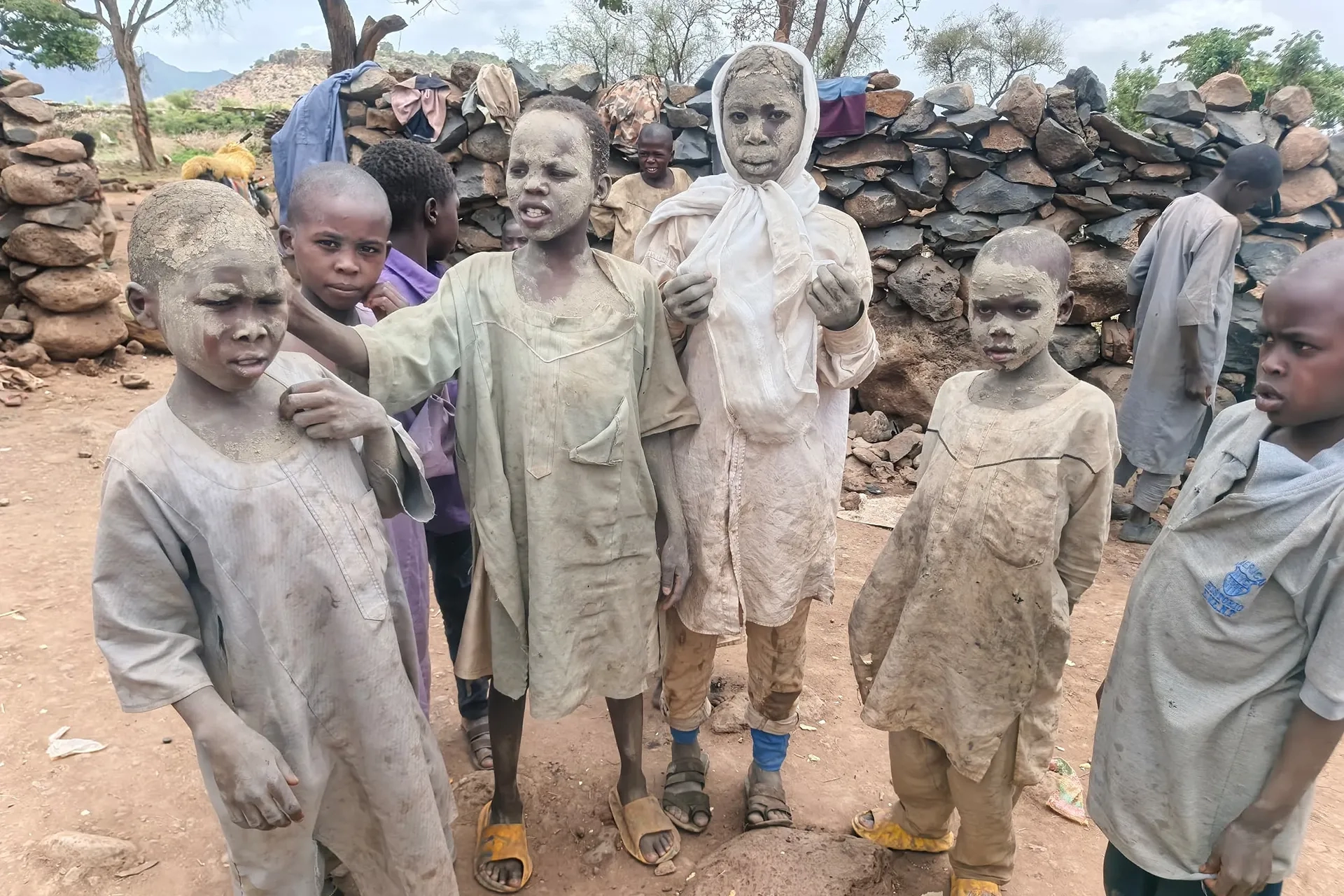 Darfur'da kızamık salgını: Sağlık sistemi çöktü