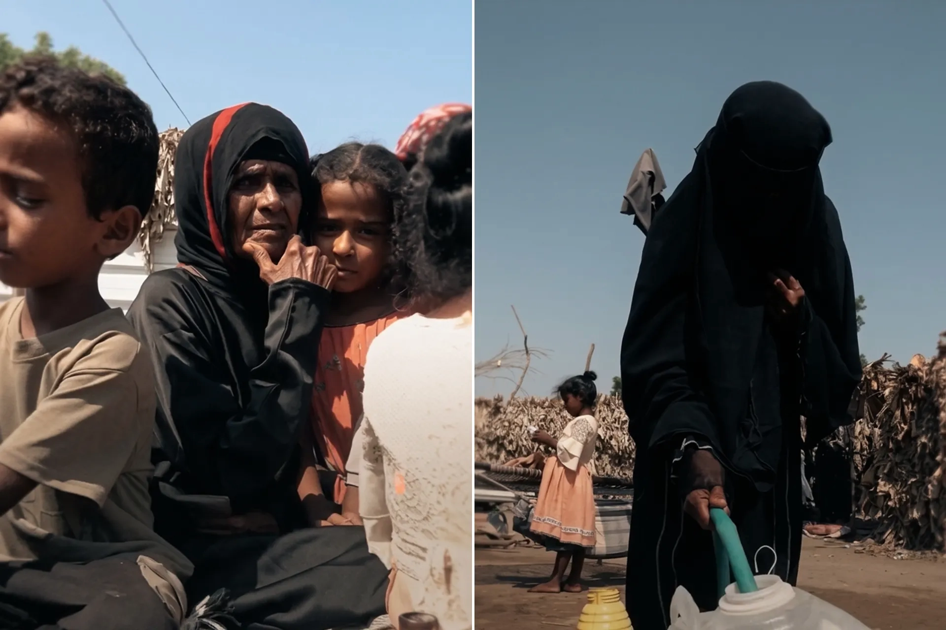Yemen'deki kamplarda kolera alarmı: Yeni göç dalgası vurdu!